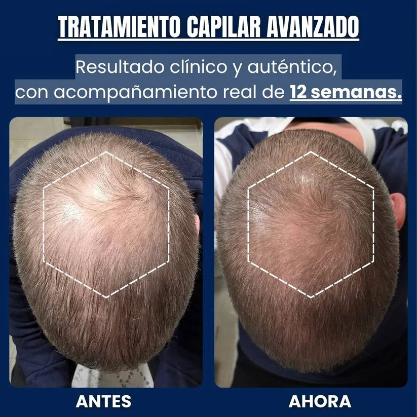 Alfagrow - Fórmula Avanzada de Péptidos de Cobre para el Crecimiento Capilar