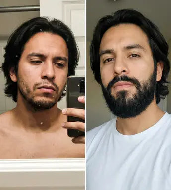 Bálsamo para Crecimiento de Barba Ultra Potente con Minoxidil 20%