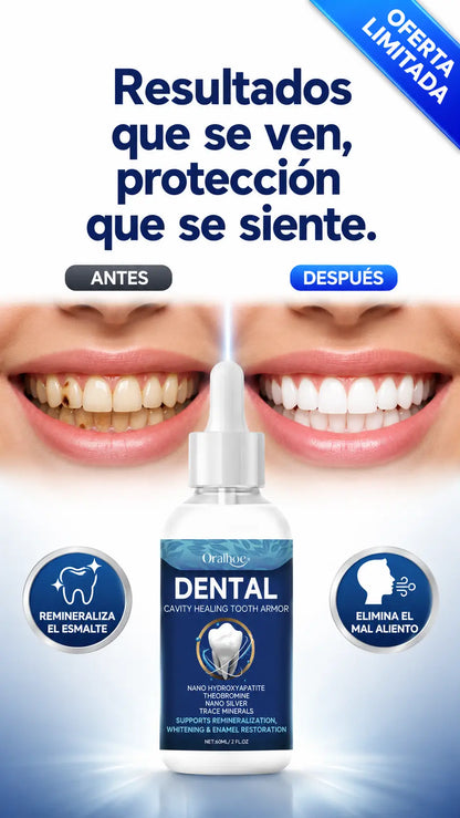 DENTAL PRO -  Tus dientes naturales no se reponen
